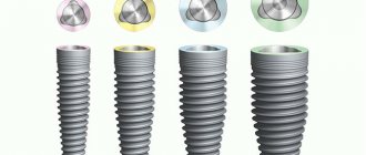 Swiss dental implants