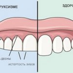 судороги во время сна