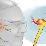 trigeminal nerve of the face