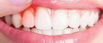 Strengthen and heal gums