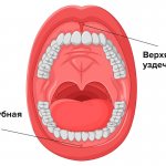 Уздечки верхней и нижней губы в картинках