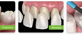 options for restoring a damaged tooth