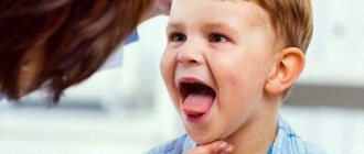 You need to monitor the child’s tongue - this is an indicator of the condition of the internal organs