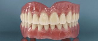 dentures with suction cups in the absence of teeth